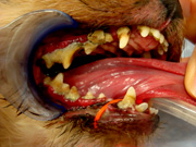 スケーリング 処置前